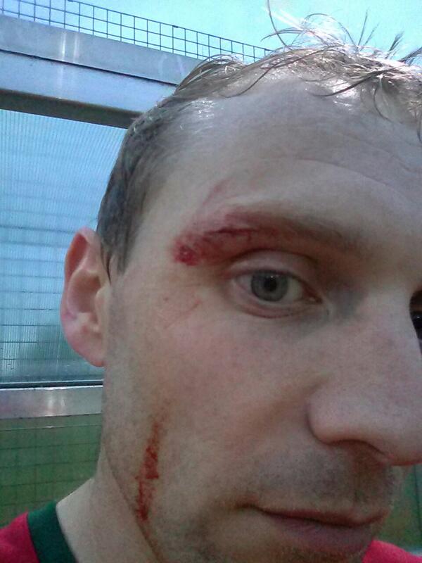Rules of hockey: #1. Hit ball with stick. #fail (cc @BromsgroveHC ). Good game, but we lost. Thanks Barford Tigers.  - embedded image